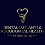 DENTAL IMPLANTS And PERIODONTAL HEALTH Profile Picture